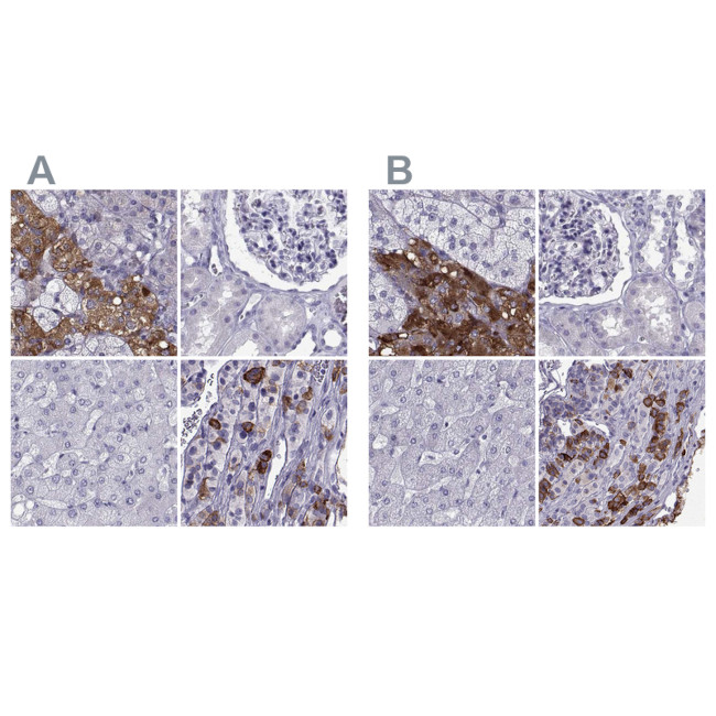 PCSK1N Antibody in Immunohistochemistry (IHC)