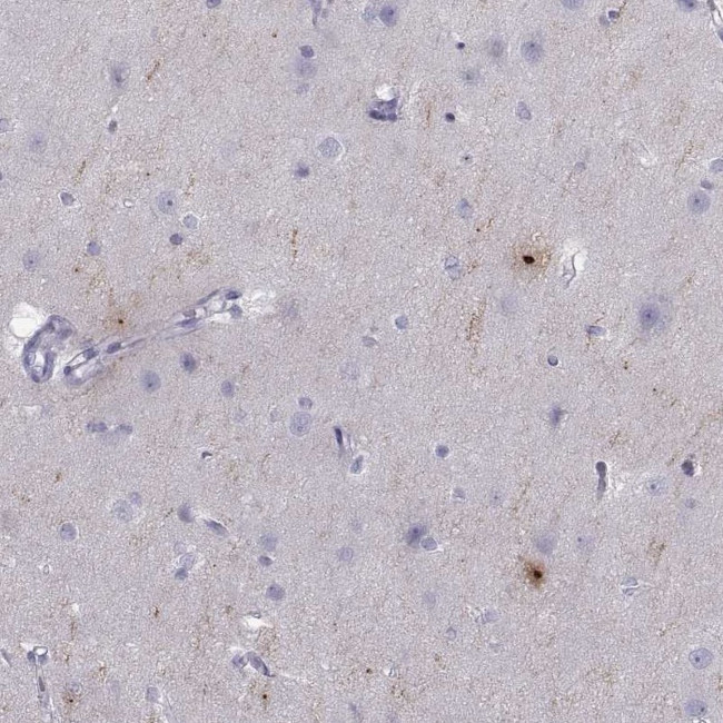 PCSK1N Antibody in Immunohistochemistry (IHC)