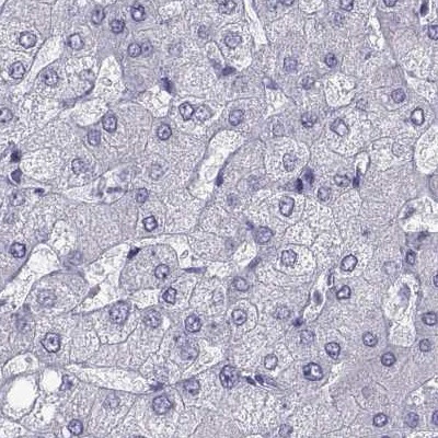 PCSK1N Antibody in Immunohistochemistry (IHC)