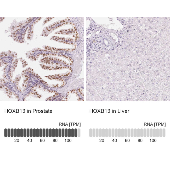 HOXB13 Antibody in Immunohistochemistry (IHC)