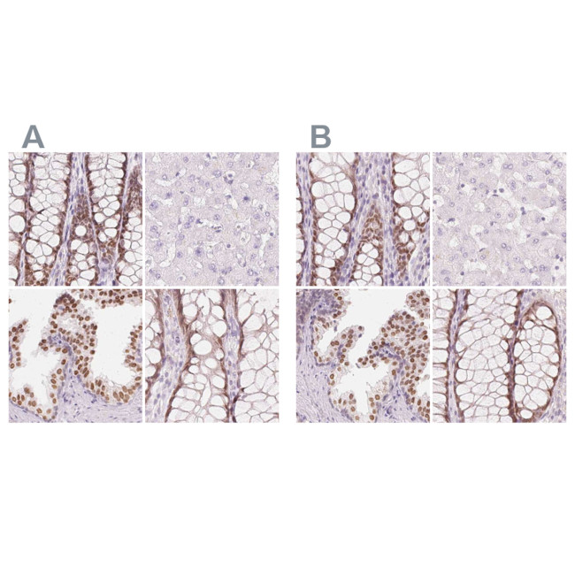 HOXB13 Antibody in Immunohistochemistry (IHC)