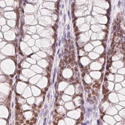 HOXB13 Antibody in Immunohistochemistry (IHC)