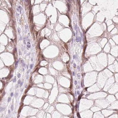 HOXB13 Antibody in Immunohistochemistry (IHC)