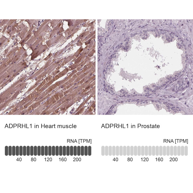 ADPRHL1 Antibody