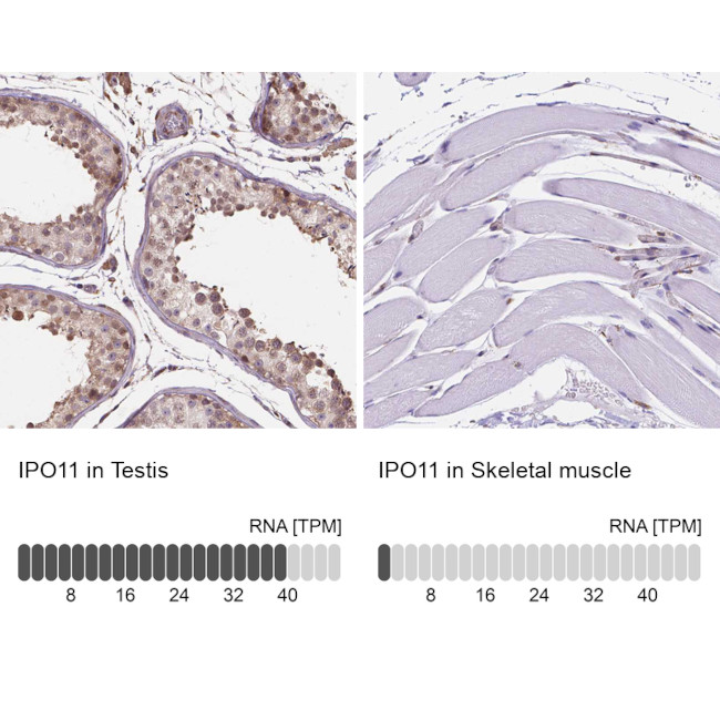 Importin 11 Antibody in Immunohistochemistry (IHC)