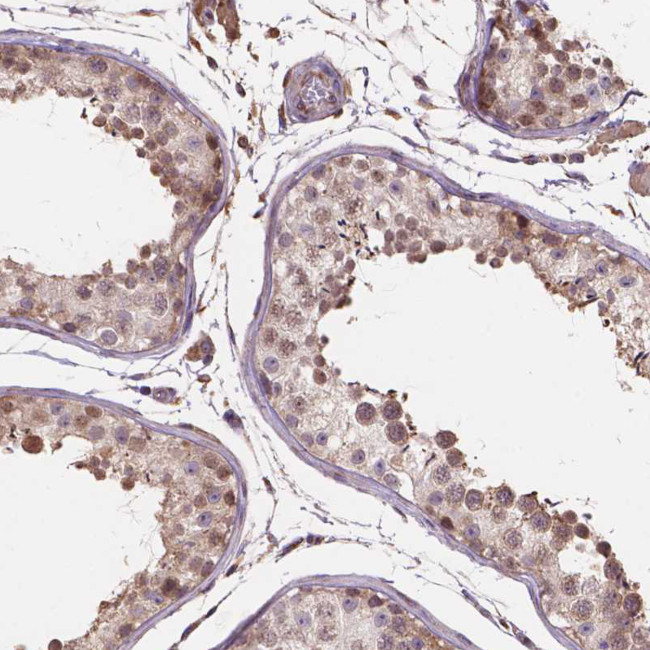 Importin 11 Antibody in Immunohistochemistry (IHC)