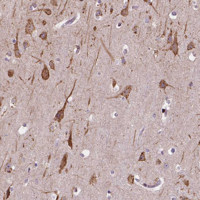 Importin 11 Antibody in Immunohistochemistry (IHC)