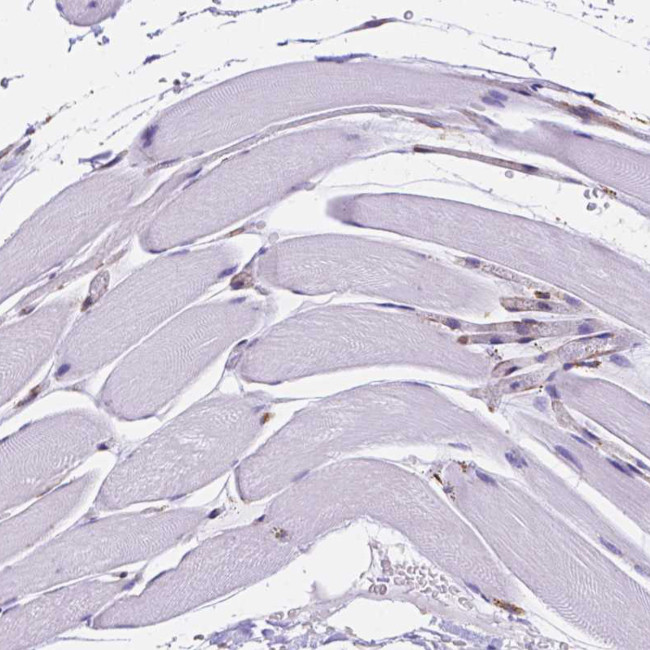 Importin 11 Antibody in Immunohistochemistry (IHC)