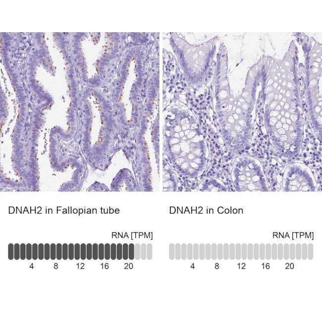 DNAH2 Antibody in Immunohistochemistry (IHC)