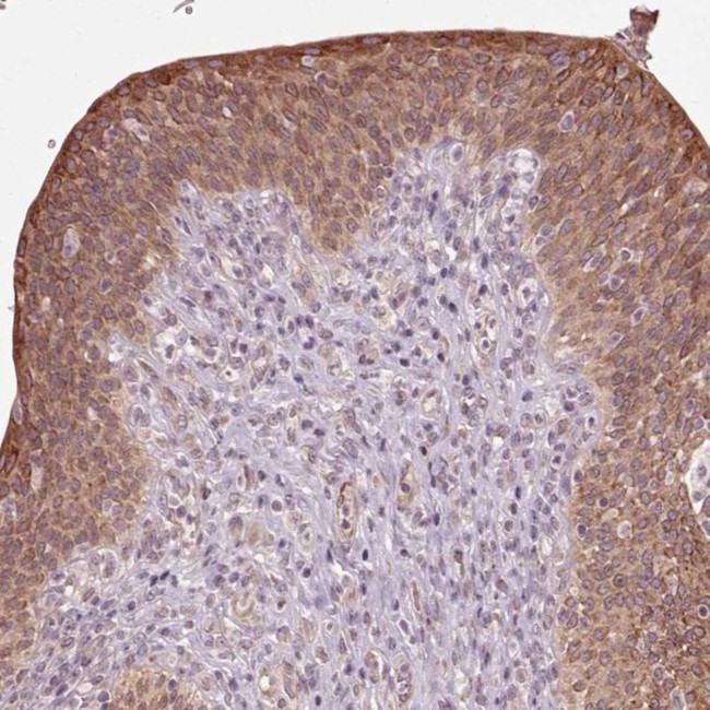 HAUS5 Antibody in Immunohistochemistry (IHC)