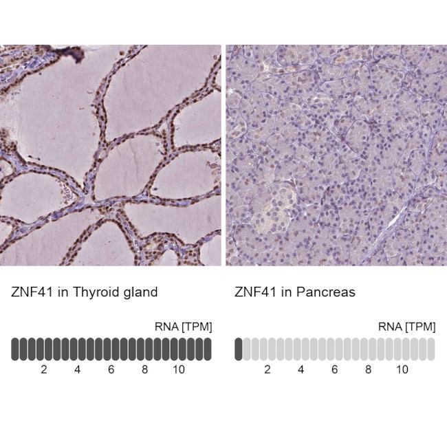 ZNF41 Antibody in Immunohistochemistry (IHC)