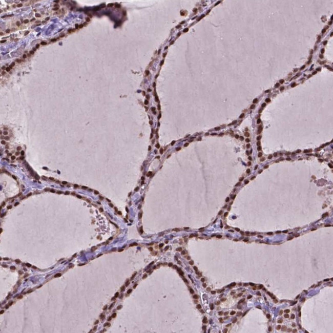 ZNF41 Antibody in Immunohistochemistry (IHC)