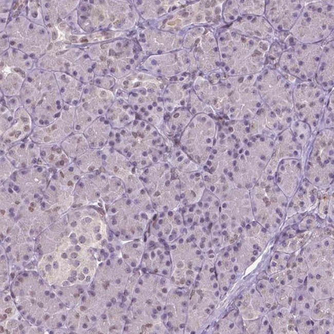 ZNF41 Antibody in Immunohistochemistry (IHC)