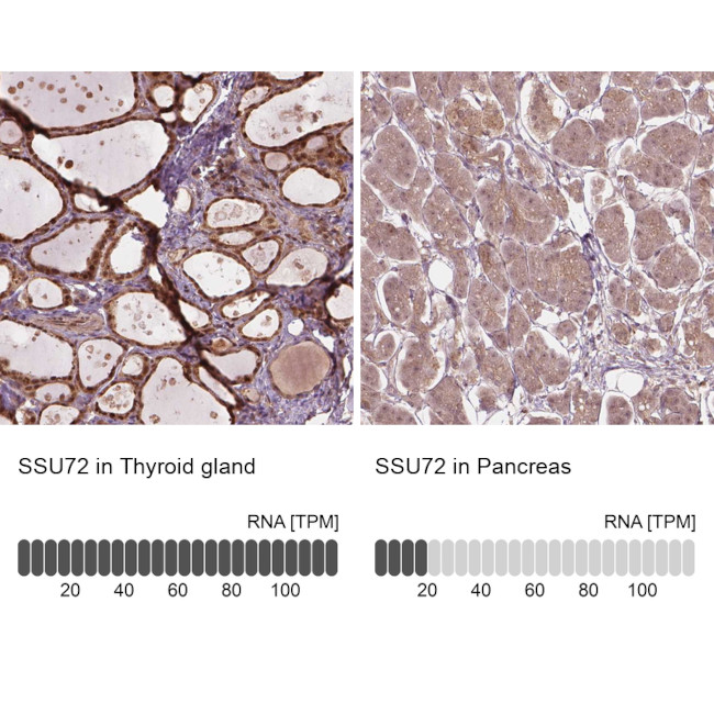 SSU72 Antibody in Immunohistochemistry (IHC)