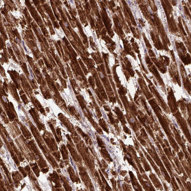 MTCO1 Antibody in Immunohistochemistry (IHC)