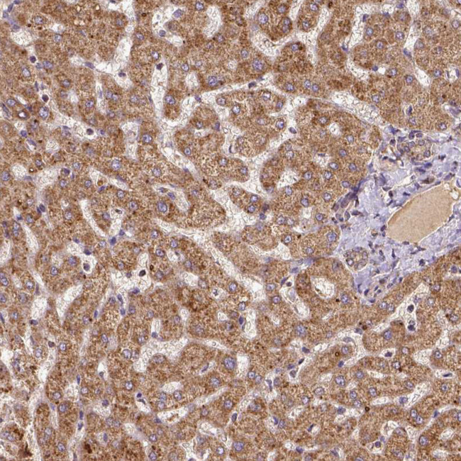 MTCO1 Antibody in Immunohistochemistry (IHC)