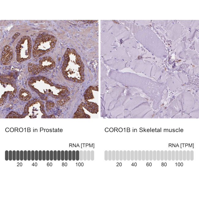 Coronin 1B Antibody in Immunohistochemistry (IHC)