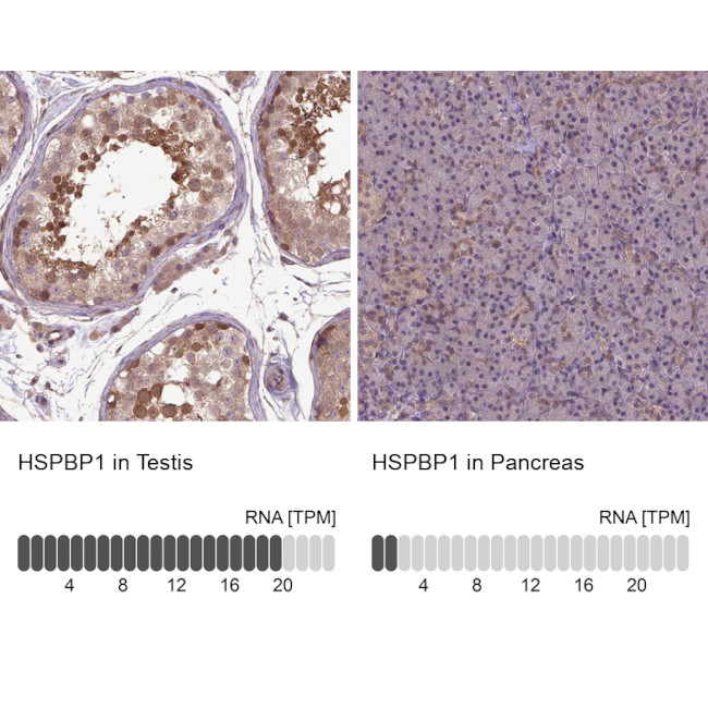 HSPBP1 Antibody in Immunohistochemistry (IHC)