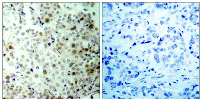 Phospho-CDK1 (Thr161) Antibody in Immunohistochemistry (Paraffin) (IHC (P))