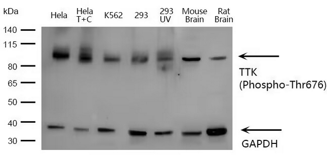 Phospho-TTK (Thr676) Antibody in Western Blot (WB)