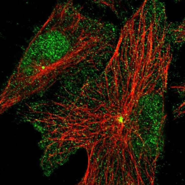 PRICKLE3 Antibody in Immunocytochemistry (ICC/IF)