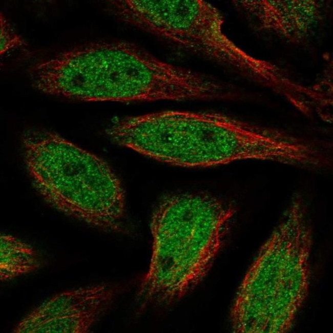 ALX4 Antibody in Immunocytochemistry (ICC/IF)