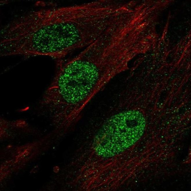 HOXA11 Antibody in Immunocytochemistry (ICC/IF)