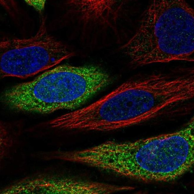 CAPZA2 Antibody in Immunocytochemistry (ICC/IF)