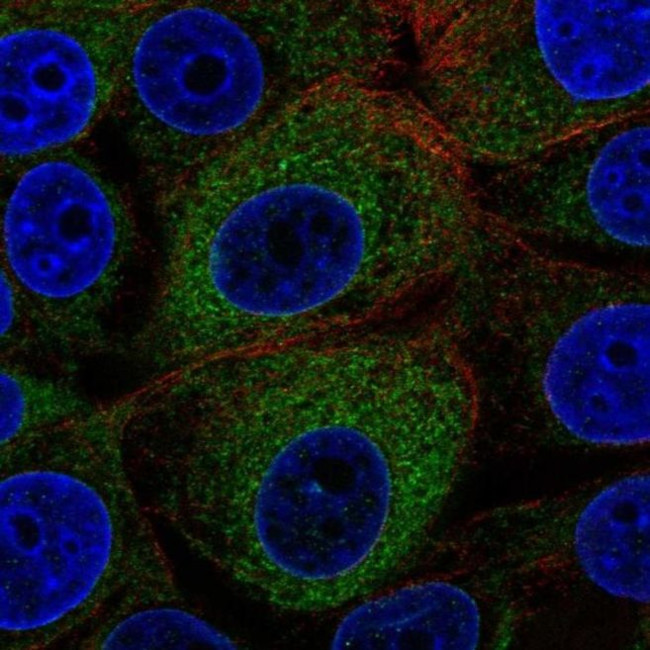 GCS1 Antibody in Immunocytochemistry (ICC/IF)