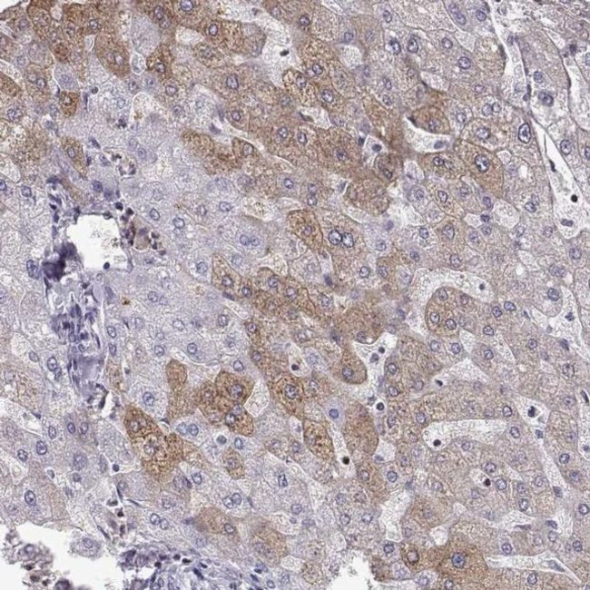 Aquaporin 0 Antibody in Immunohistochemistry (IHC)