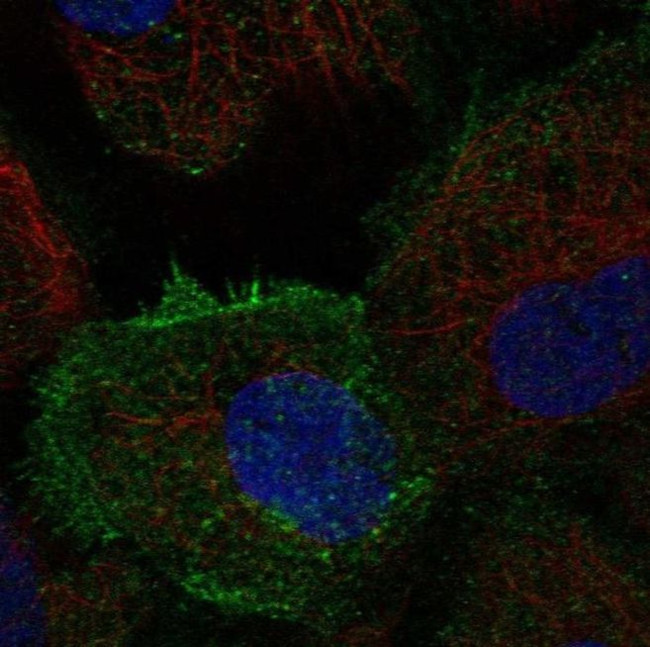 TEC Antibody in Immunocytochemistry (ICC/IF)