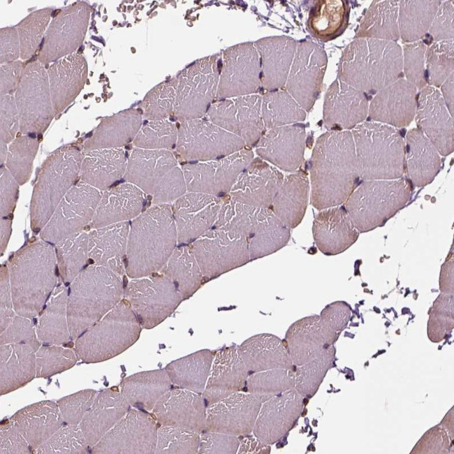 HTR1B Antibody in Immunohistochemistry (IHC)