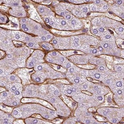 COL6A2 Antibody in Immunohistochemistry (IHC)