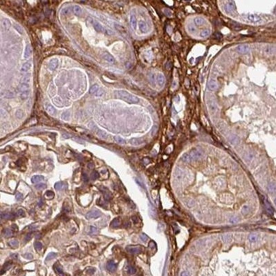 COL6A2 Antibody in Immunohistochemistry (IHC)