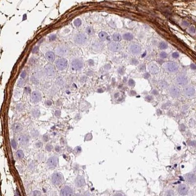 COL6A2 Antibody in Immunohistochemistry (IHC)