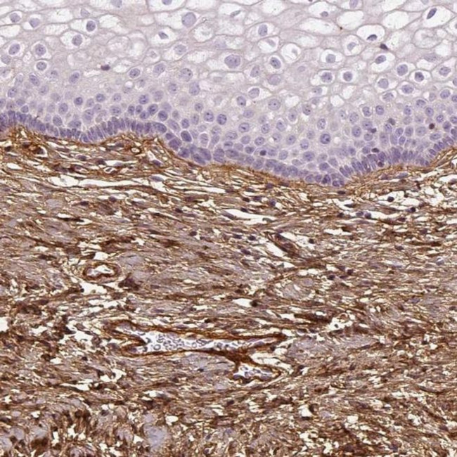 COL6A2 Antibody in Immunohistochemistry (IHC)