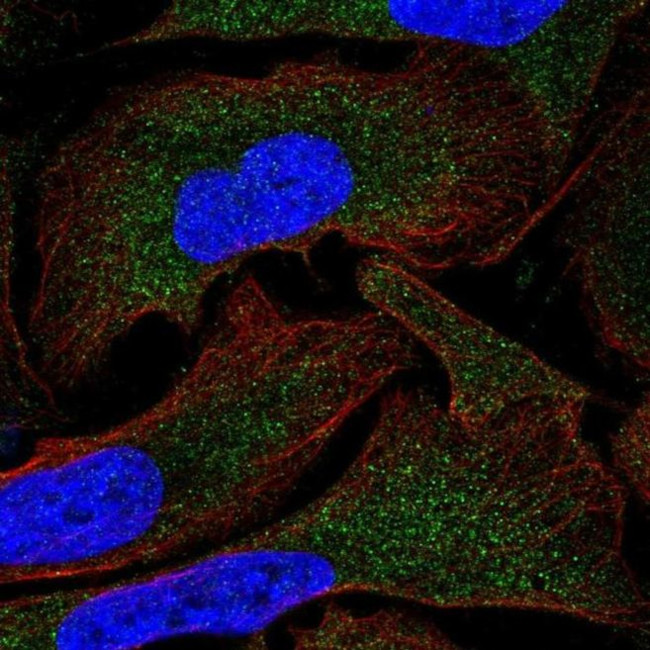 MOV10 Antibody in Immunocytochemistry (ICC/IF)