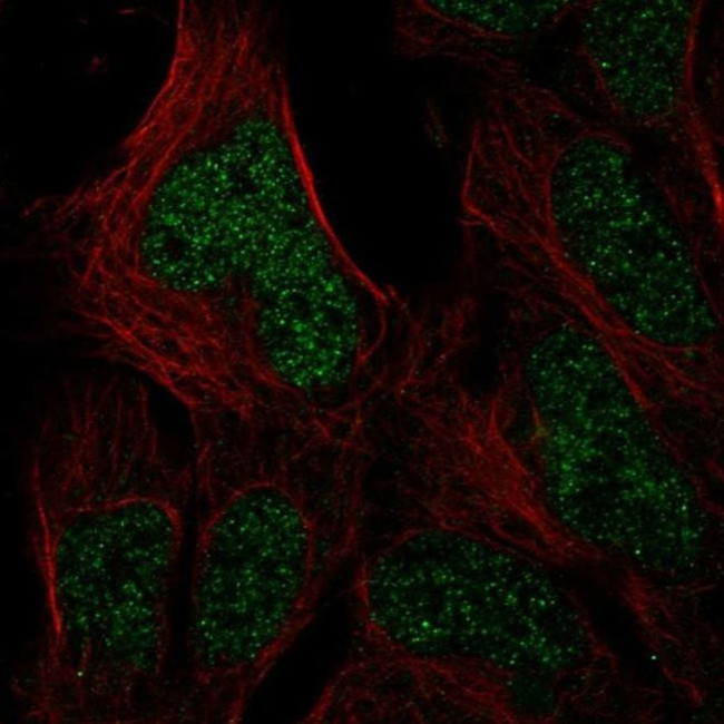 HUS1B Antibody in Immunocytochemistry (ICC/IF)