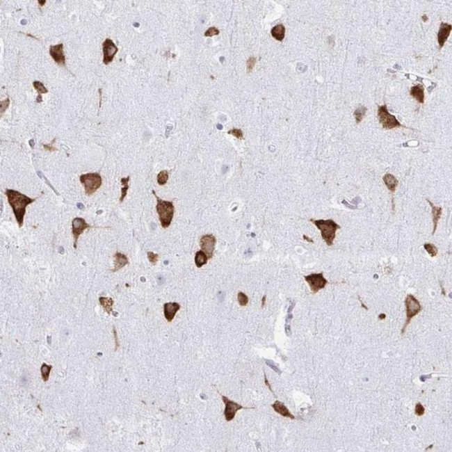 PACT Antibody in Immunohistochemistry (IHC)