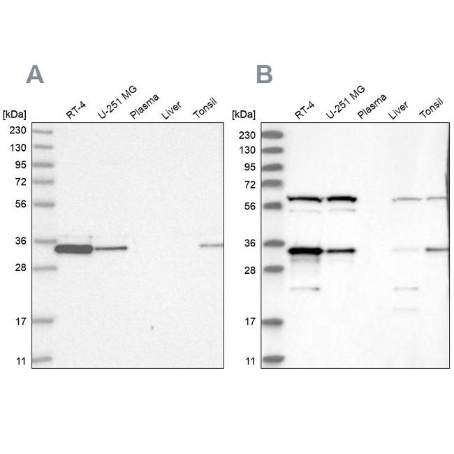 PACT Antibody in Western Blot (WB)