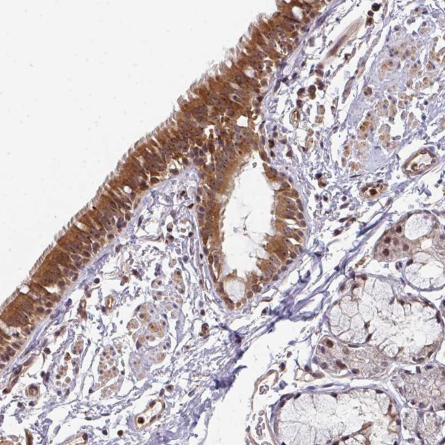 SIMC1 Antibody in Immunohistochemistry (IHC)