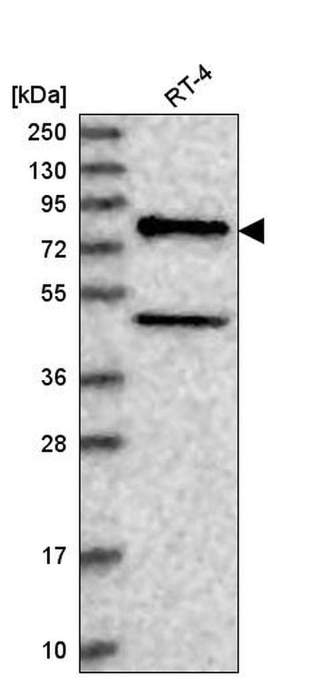 NADSYN1 Antibody in Western Blot (WB)