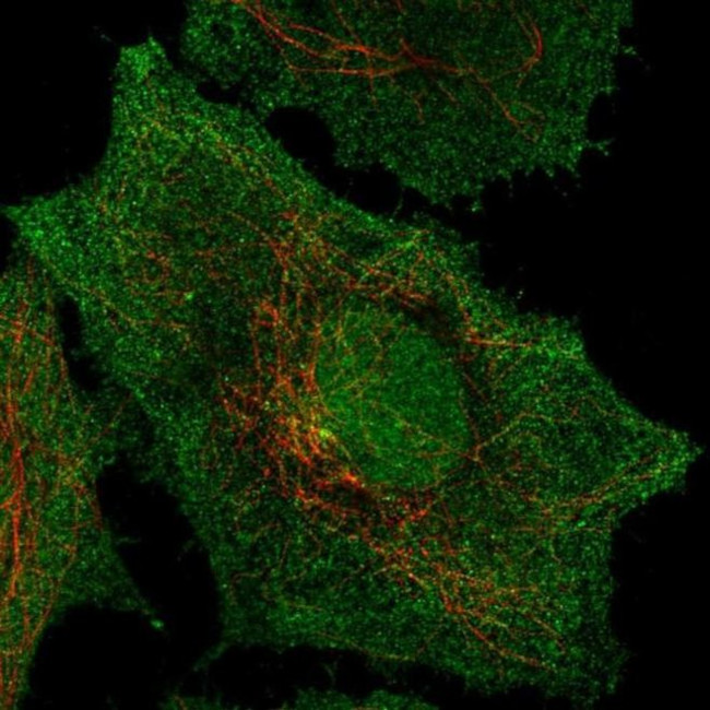 SPPL2B Antibody in Immunocytochemistry (ICC/IF)