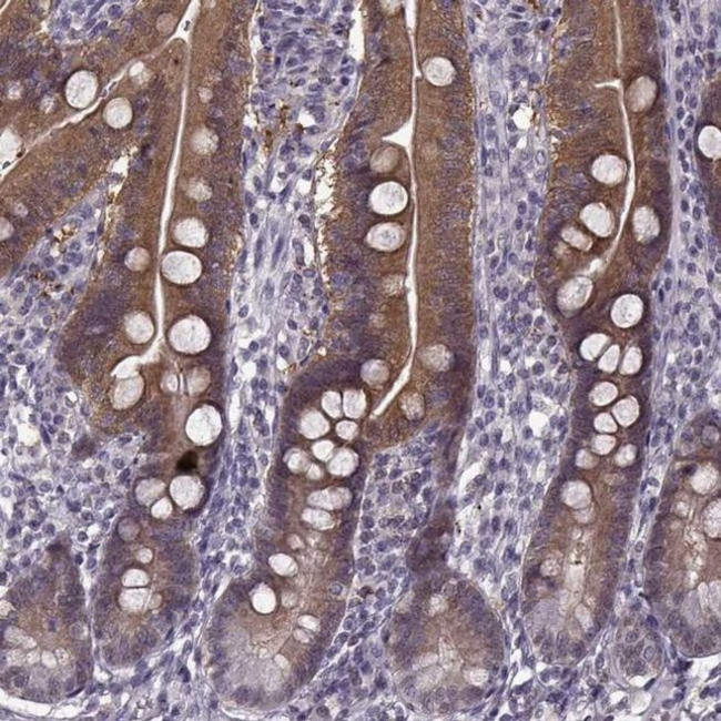 ACOT11 Antibody in Immunohistochemistry (IHC)