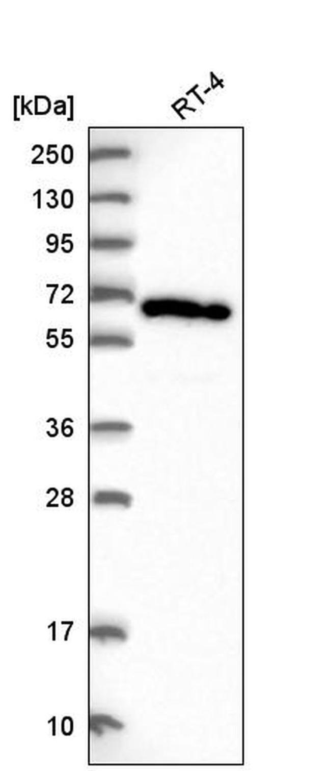 ACOT11 Antibody in Western Blot (WB)