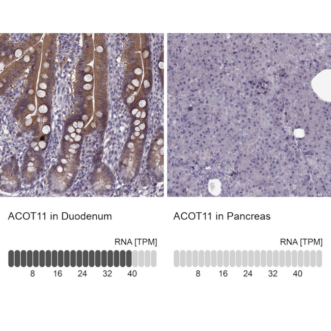 ACOT11 Antibody