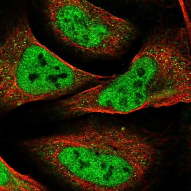 WHSC2 Antibody in Immunocytochemistry (ICC/IF)