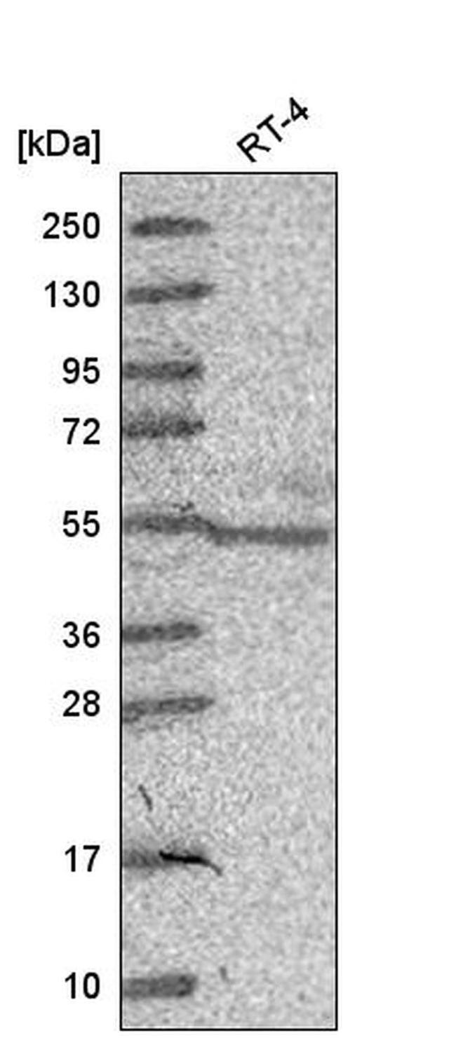 GCNF Antibody in Western Blot (WB)