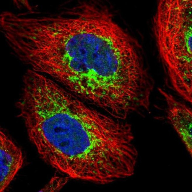 ACAD9 Antibody in Immunocytochemistry (ICC/IF)