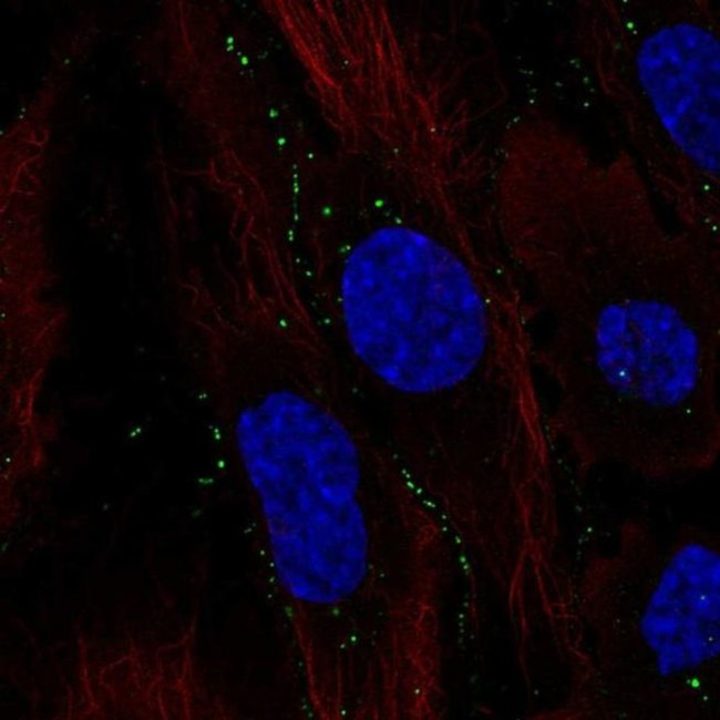 C11orf91 Antibody in Immunocytochemistry (ICC/IF)